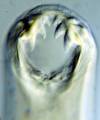 Microscopisch beeld van een haakworm, met de tandvormige structuren haakt de worm zich letterlijk vast aan de binnenkant van de darm